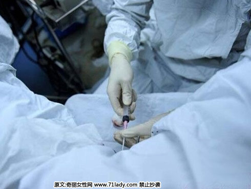 实拍试管婴儿全过程,解决不孕不育的夫妻问题,可以通过人工受孕来完成试管婴儿,下面奇丽女性小编为大家图解试管婴儿全过程吧。