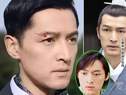 胡歌车祸前后照片 车祸毁容后容貌大变样