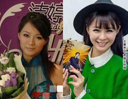 沈梦辰整容对比照曝光 旧照与整容后对比差别很大
