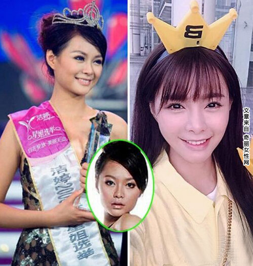 沈梦辰整容对比照曝光 旧照与整容后对比差别很大