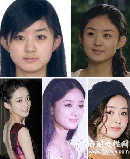 赵丽颖整容前后照片 整容前脸又方又圆整容后秒变小圆脸女神