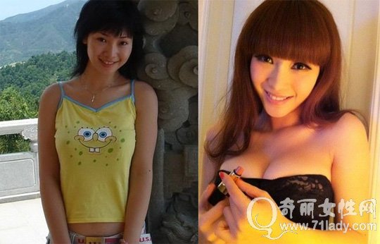 柳岩丰胸前后对比照片