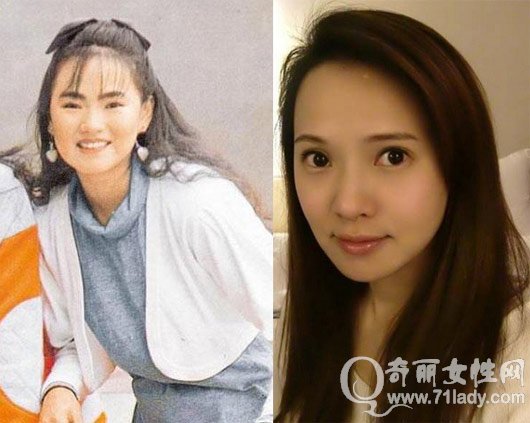 伊能静整容前后对比照