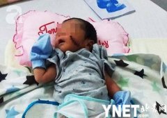 气愤！越南男婴被活埋 脸上有4厘米长的伤口